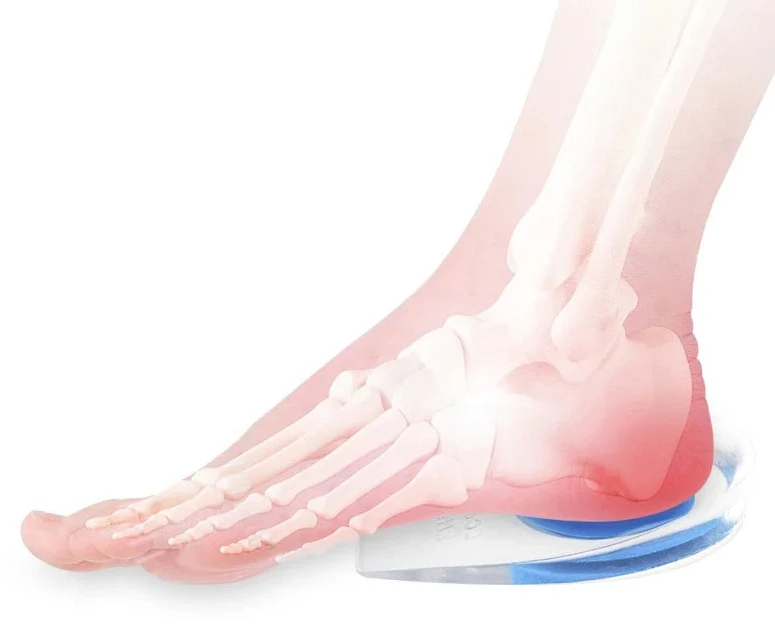 Plantar Fasciitis Heel Cups - Image 6