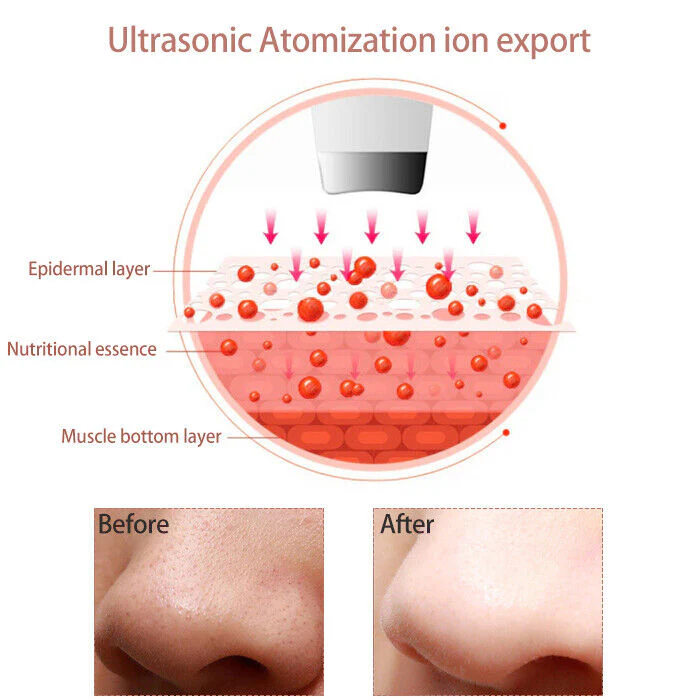 Ultrasonic Facial Skin Scrubber - Image 4