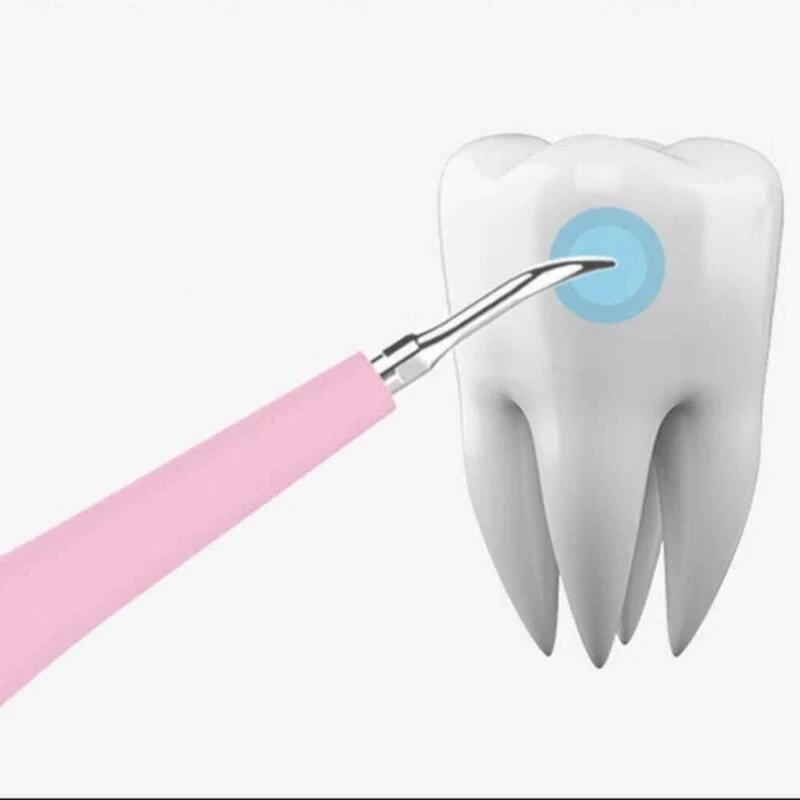 Ultrasonic Tooth Cleaning Wand - Image 4
